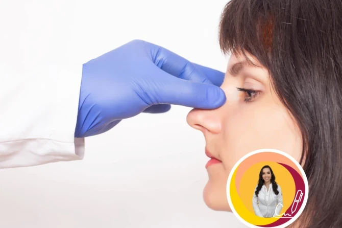 O que é rinoplastia? Tudo sobre o assunto