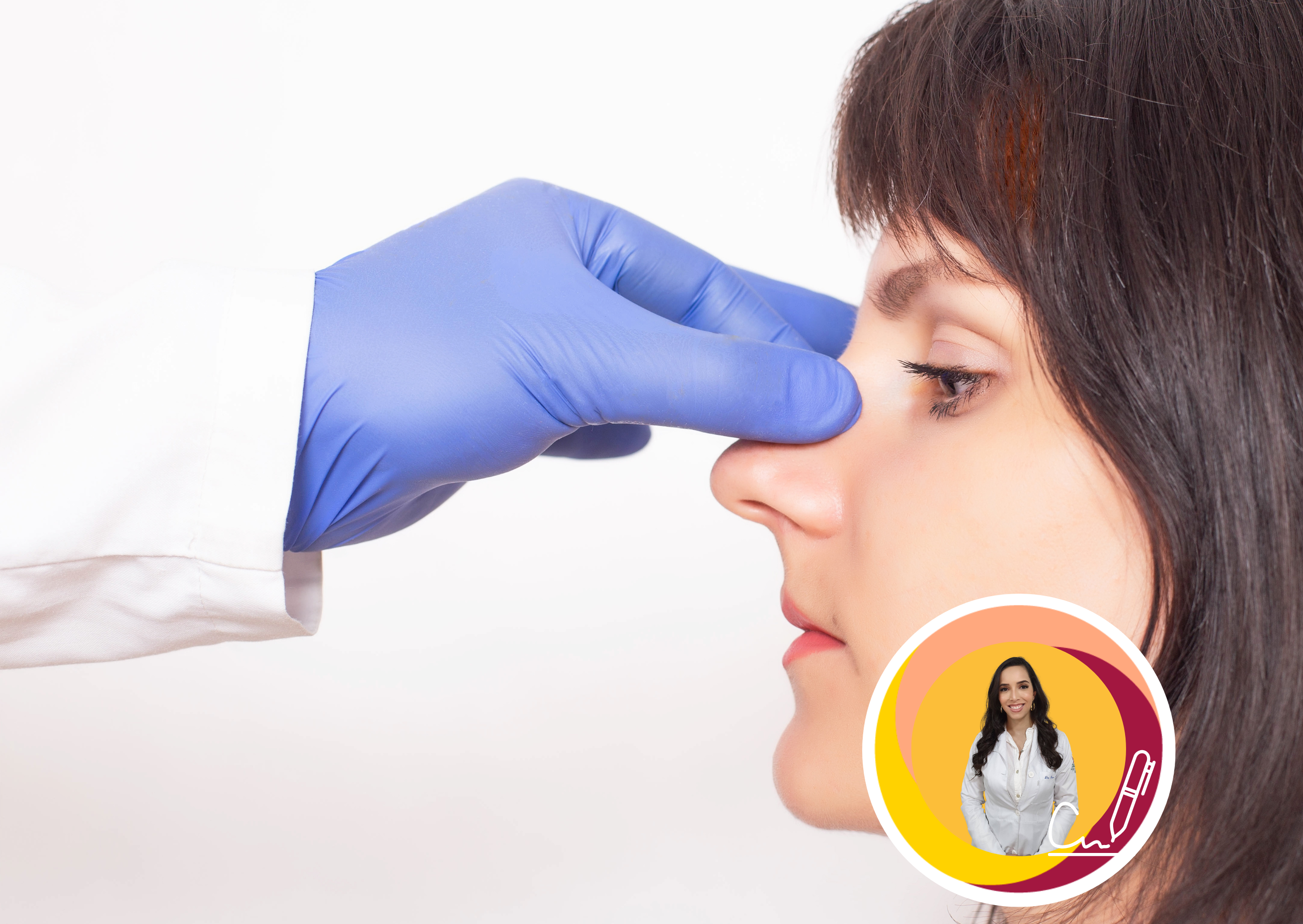 O que é rinoplastia? Tudo sobre o assunto